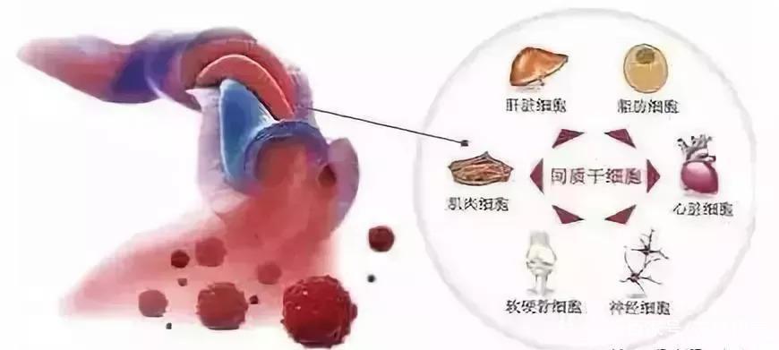 最新干细胞治疗肝硬化研究突破进展